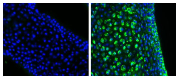 Frozen newborn mouse cartilage sections were blocked with Normal Rabbit Serum (SB Cat. No. 0040-01) and stained with Mouse Anti-Collagen Type II-UNLB (right) followed by Rabbit F(ab')<sub>2</sub> Anti-Mouse IgG(H+L), Human ads-BIOT (SB Cat. No. 6125-08), Streptavidin-FITC (SB Cat. No. 7100-02), DAPI, and mounted with Fluoromount-G<sup>®</sup> Anti-Fade (SB Cat. No. 0100-35).