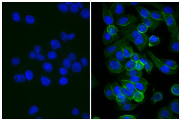 Human pancreatic carcinoma cell line MIA PaCa-2 was blocked with Normal Rabbit Serum (SB Cat. No. 0040-01) and stained with Mouse Anti-Human CD44-UNLB (SB Cat. No. 9400-01; right) followed by Rabbit Anti-Mouse IgG(H+L), Human ads-BIOT (SB Cat. No. 6175-08), Streptavidin-FITC (SB Cat. No. 7100-02), and DAPI.