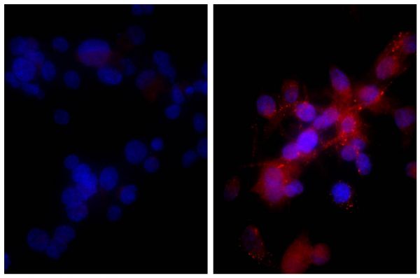 Human hepatocellular carcinoma cell line Hep G2 was stained with Rabbit IgG-UNLB isotype control (SB Cat. No. 0111-01; left) and Rabbit Anti-Human DR5-UNLB (SB Cat. No. 6600-01; right) followed by Donkey Anti-Rabbit IgG(H+L), Mouse/Rat/Human SP ads-BIOT (SB Cat. No. 6440-08, Streptavidin-CY3 (SB Cat. No. 7100-12), and DAPI.