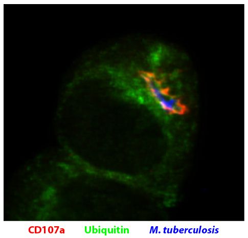 DC2.4 cells were infected with AF405 labeled M. tuberculosis and stained with Rat Anti-Mouse CD107a-UNLB (SB Cat. No. 1920-01) and anti-ubiquitin followed by secondary antibodies.<br/>Image from Seto S, Tsujimura K, Horii T, Koide Y. Autophagy adaptor protein p62-SQSTM1 and autophagy-related gene Atg5 mediate autophagosome formation in response to <i>Mycobacterium tuberculosis</i> infection in dendritic cells. PLoS One. 2013;8(12):e86017. Figure 4(c)<br/>Reproduced under the Creative Commons license https://creativecommons.org/licenses/by/4.0/