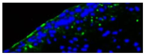 Frozen section of lamina fibrosa from porcine aortic valve leaflet subjected to bicuspid aortic value wall shear stress was stained with Rat Anti-Mouse CD54-UNLB (SB Cat. No. 1701-01) followed by a secondary antibody and DAPI.<br/>Image from Sun L, Chandra S, Sucosky P. Ex vivo evidence for the contribution of hemodynamic shear stress abnormalities to the early pathogenesis of calcific bicuspid aortic valve disease. PLoS One. 2012;7(10):e48843. Figure 5<br/>Reproduced under the Creative Commons Attribution License