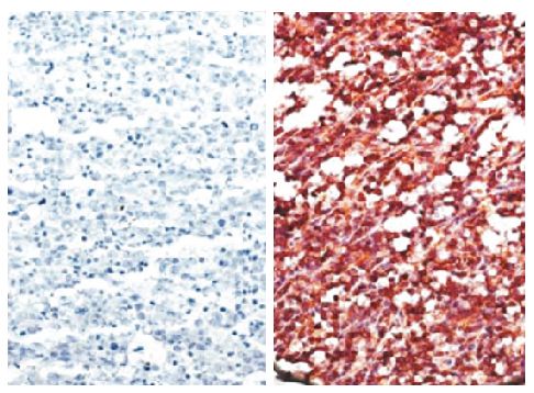 Paraffin embedded AIDS-associated Burkitt lymphoma tissue array was stained with anti-CXCR5 (right) and Rat IgG<sub>2b</sub>-UNLB (SB Cat. No. 0118-01; left) followed by a secondary antibody and Fast Red.<br/>Images from Widney DP, Gui D, Popoviciu LM, Said JW, Breen EC, Huang X, et al. Expression and function of the chemokine, CXCL13, and its receptor, CXCR5, in AIDS-associated non-Hodgkin's lymphoma. AIDS Research and Treatment. 2010;2010:164586. Figure 2(a)<br/>Reproduced under the Creative Commons license https://creativecommons.org/licenses/by/3.0/