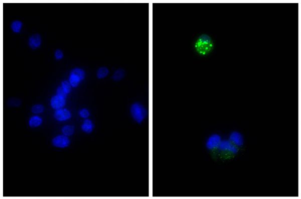 Human hepatocellular carcinoma cell line Hep G2 was stained with Rabbit Anti-Human DR5-UNLB (SB Cat. No. 6600-01; right) and Rabbit IgG-UNLB (SB Cat. No. 0111-01; left) followed by Donkey F(ab')<sub>2</sub> Anti-Rabbit IgG(H+L), Mouse/Rat/Human SP ads-AF488 (SB Cat. No. 6442-30) and DAPI.