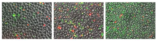 Human T lymphocyte cell line Jurkat was stained with ApoScreen<sup>®</sup> Annexin V-FITC (SB Cat No. 10039-02) and ApoScreen<sup>®</sup> 7-Aminoactinomycin D (7-AAD; SB Cat. No. 10042-01) at varying stages of apoptosis. (Green - Annexin V-FITC; 7-AAD - Red)