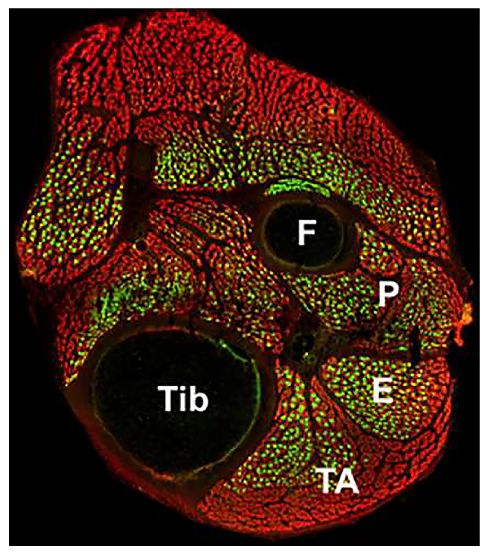 Frozen mouse skeletal muscle tissue was stained with anti-myosin heavy chain and anti-myosin heavy chain type I followed by Goat Anti-Mouse IgG, Human ads-AF555 (SB Cat. No. 1030-32) and Goat Anti-Mouse IgM-FITC (SB Cat. No. 1021-02).<br/>Image from Cortez-Toledo O, Schnair C, Sangngern P, Metzger D, Chao LC. Nur77 deletion impairs muscle growth during developmental myogenesis and muscle regeneration in mice. PLoS One. 2017;12(2):e0171268. Figure 3(a)<br/>Reproduced under the Creative Commons license https://creativecommons.org/licenses/by/4.0/