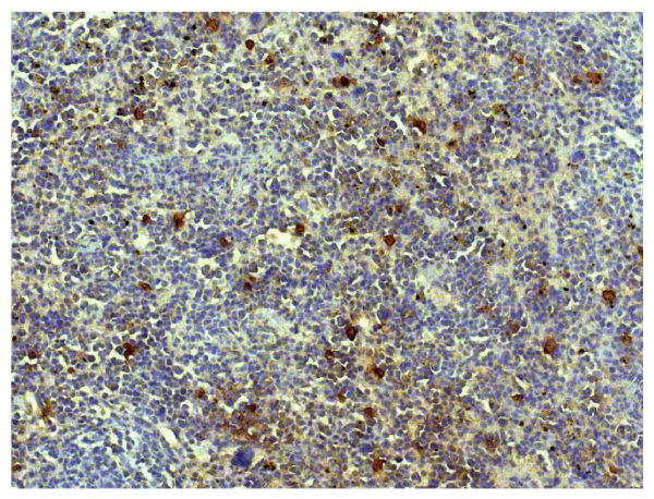 Paraffin embedded mouse spleen section was stained with Goat Anti-Mouse IgA-UNLB (SB Cat. No. 1040-01) followed by Donkey Anti-Goat IgG(H+L), Mouse/Rat SP ads-HRP (SB Cat. No. 6420-05), DAB, and hematoxylin.