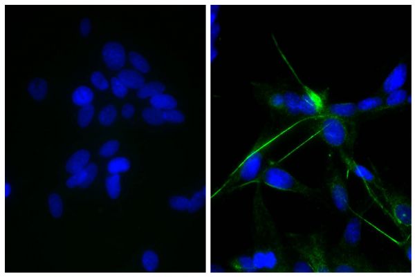 Human astrocytoma cell line CCF-STTG1 was stained with Mouse Anti-Human GFAP-UNLB (SB Cat. No. 12075-01; right) followed by Rabbit Anti-Mouse IgG(H+L), Human ads-FITC (SB Cat. No. 6175-02) and DAPI.