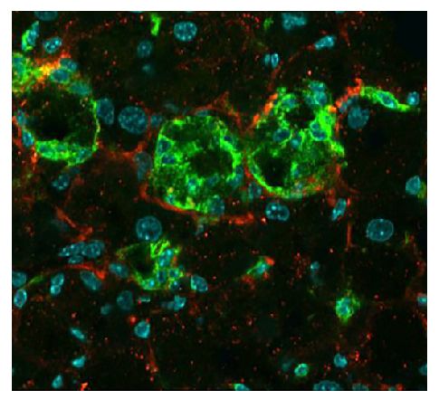 Frozen MC4R-KO mouse liver section was stained with Goat Anti-Type I Collagen-UNLB (SB Cat. No. 1310-01) and anti-F4/80 followed by secondary antibodies and DAPI.<br/>Image from Itoh M, Kato H, Suganami T, Konuma K, Marumoto Y, Terai S, et al. Hepatic crown-like structure: a unique histological feature in non-alcoholic steatohepatitis in mice and humans. PLoS One. 2013;8(12):e82163. Figure 2(e)<br/>Reproduced under the Creative Commons license https://creativecommons.org/licenses/by/3.0/