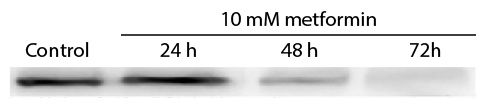 Cleared protein lysates from 10E1-CEM cells treated with metformin for indicated times were resolved by electrophoresis, transferred to nitrocellulose membrane, and probed with anti-cdc2 p34 followed by Goat F(ab')<sub>2</sub> Anti-Mouse IgG(H+L), Human ads-HRP (SB Cat. No. 1032-05) and chemiluminescent detection.<br/>Image from Rodríguez-Lirio A, Pérez-Yarza G, Fernández-Suárez MR, Alonso-Tejerina E, Boyano MD, Asumendi A. Metformin induces cell cycle arrest and apoptosis in drug-resistant leukemia cells. Leuk Res Treatment. 2015;2015:516460. Figure 6<br/>Reproduced under the Creative Commons license https://creativecommons.org/licenses/by/4.0/