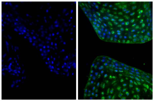 Frozen newborn mouse cartilage section was stained with Goat Anti-Type II Collagen-UNLB (SB Cat. No. 1320-01; right) followed by Donkey Anti-Goat IgG(H+L), Mouse/Rat SP ads-AF488 (SB Cat. No. 6420-30) and DAPI.