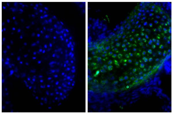 Frozen newborn mouse cartilage section was stained with Goat Anti-Type II Collagen-UNLB (SB Cat. No. 1320-01; right) followed by Donkey Anti-Goat IgG(H+L), Mouse/Rat SP ads-BIOT (SB Cat. No. 6420-08), Streptavidin-FITC (SB Cat. No. 7100-02), and DAPI.