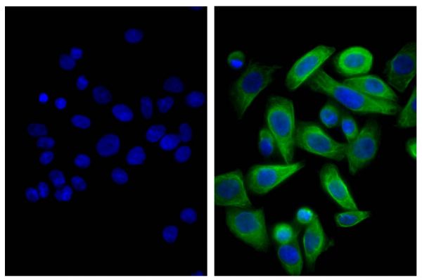 Human pancreatic carcinoma cell line MIA PaCa-2 was stained with Mouse Anti-Cytokeratin 18-UNLB (SB Cat. No. 10085-01; right) followed by Donkey Anti-Mouse IgG(H+L), Human SP ads-AF488 (SB Cat. No. 6410-30) and DAPI.