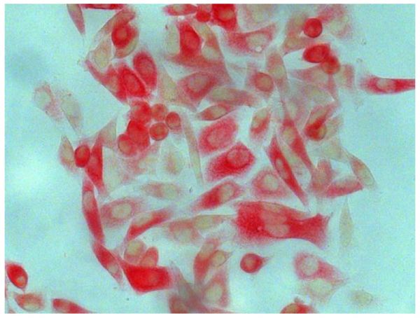 Human pancreatic carcinoma cell line MIA PaCa-2 was stained with Mouse Anti-Cytokeratin 8-UNLB (SB Cat. No. 10080-01) followed by Goat Anti-Mouse IgG<sub>2a</sub>, Human ads-AP (SB Cat. No. 1080-04), Red AP, and mounted with Fluoromount-G<sup>®</sup> (SB Cat. No. 0100-01).