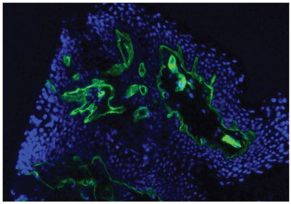 Frozen human skin tissue section was stained with Mouse Anti-Type IV Collagen-UNLB (SB Cat. No. 1460-01) followed by Goat Anti-Mouse IgG<sub>1</sub>, Human ads-AF488 (SB Cat. No. 1070-30) and DAPI.