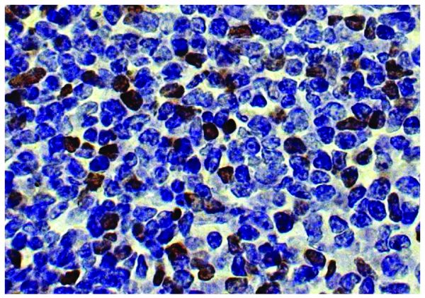 Paraffin embedded mouse spleen tissue was stained with Rat Anti-Mouse Foxp3-UNLB (SB Cat. No. 12400-01) followed by HRP conjugated Anti-Rat Ig secondary antibody, DAB, and hematoxylin.
