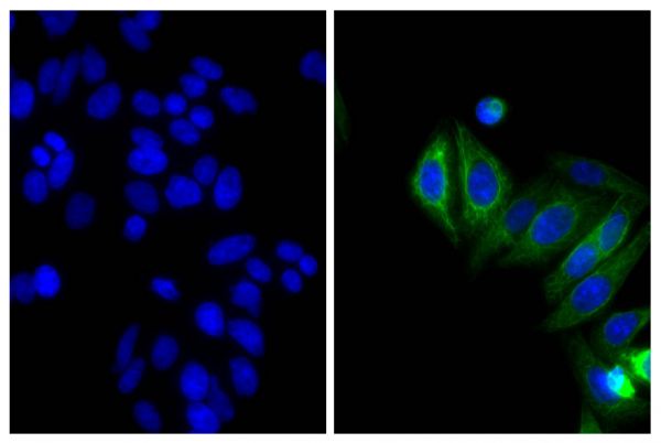 Human epithelial carcinoma cell line HEp-2 was stained with Mouse Anti-Cytokeratin 18-UNLB (SB Cat. No. 10085-01; right) followed by Goat Anti-Mouse IgG<sub>2b</sub>, Human/Bovine/Horse SP ads-BIOT (SB Cat. No. 1093-08), Streptavidin-CY2 (SB Cat. No. 7100-21), and DAPI.