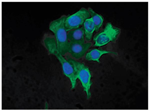 Human pancreatic carcinoma cell line MIA PaCa-2 was stained with Mouse Anti-Cytokeratin 8-FITC (SB Cat. No. 10080-02) followed by DAPI.