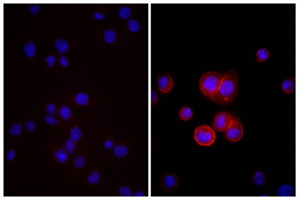 Human pancreatic carcinoma cell line MIA PaCa-2 was stained with Mouse Anti-Human CD44-UNLB (SB Cat. No. 9400-01; right) followed by Donkey Anti-Mouse IgG(H+L), Multi-Species SP ads-BIOT (SB Cat. No. 6415-08), Streptavidin-TXRD (SB Cat. No. 7100-07), and DAPI.