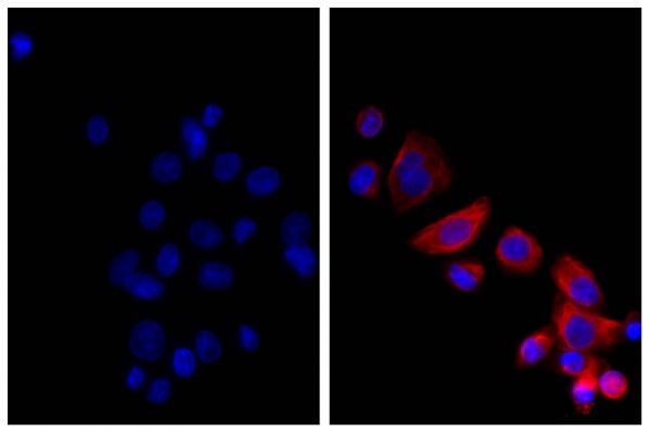 Human pancreatic carcinoma cell line MIA PaCa-2 was stained with Mouse Anti-Cytokeratin 18-UNLB (SB Cat. No. 10085-01; right) followed by Donkey Anti-Mouse IgG(H+L), Multi-Species SP ads-AF555 (SB Cat. No. 6415-32) and DAPI.