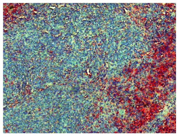 Paraffin embedded mouse spleen section was stained with Goat Anti-Mouse Kappa-UNLB (SB Cat. No. 1050-01) followed by Donkey Anti-Goat IgG(H+L), Mouse/Rat SP ads-AP (SB Cat. No. 6420-04), Red AP, and hematoxylin.