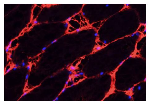 Frozen rat gastrocnemic muscle section was stained with Goat Anti-Rat IgM-BIOT (SB Cat. No. 3020-08) followed by a CY3 secondary reagent and DAPI.<br/>Image from Duehrkop C, Banz Y, Spirig R, Miescher S, Nolte MW, Spycher M, et al. C1 esterase inhibitor reduces lower extremity ischemia/reperfusion injury and associated lung damage. PLoS One. 2013;8(8):e72059. Figure 2(h)<br/>Reproduced under the Creative Commons Attribution License