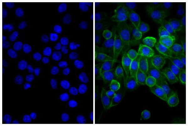 Human pancreatic carcinoma cell line MIA PaCa-2 was stained with Mouse Anti-Human CD44-UNLB (SB Cat. No. 9400-01; right) followed by Donkey Anti-Mouse IgG(H+L), Human SP ads-FITC (SB Cat. No. 6410-02) and DAPI.