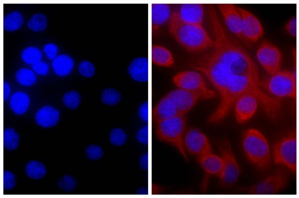Human pancreatic carcinoma cell line MIA PaCa-2 was stained with Mouse Anti-Cytokeratin 18-UNLB (SB Cat. No. 10085-01; right) followed by Goat Anti-Mouse IgG(H+L), Rat ads-TRITC (SB Cat. No. 1034-03) and DAPI.