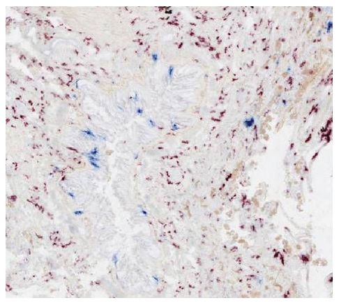 Biotin Goat Anti-Mouse IgG1, Human Adsorbed | SouthernBiotech
