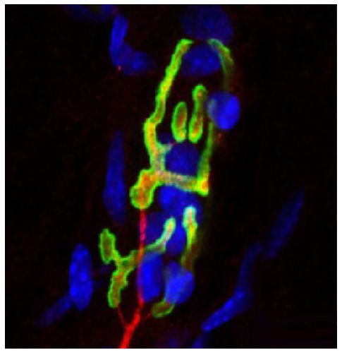 もも  ボールポイントカラービット 1本組 H4×100 | ANEXブランドの