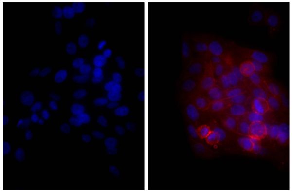 Human epithelial carcinoma cell line HEp-2 was stained with Mouse Anti-Human CD44-UNLB (SB Cat. No. 9400-01; right) followed by Goat Anti-Mouse Ig, Human ads-TXRD (SB Cat. No. 1010-07) and DAPI.