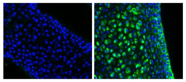 Frozen newborn mouse cartilage sections were blocked with Normal Rabbit Serum (SB Cat. No. 0040-01) and stained with Mouse Anti-Collagen Type II-UNLB (right) followed by Rabbit F(ab')<sub>2</sub> Anti-Mouse IgG(H+L), Human ads-BIOT (SB Cat. No. 6125-08),
