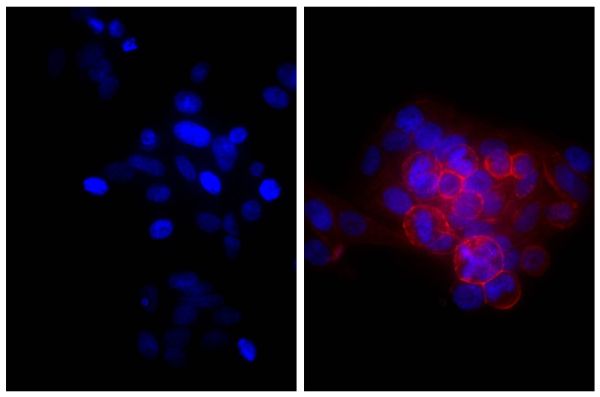 Human epithelial carcinoma cell line HEp-2 was stained with Mouse Anti-Human CD44-UNLB (SB Cat. No. 9400-01; right) followed by Goat Anti-Mouse Ig, Human ads-TRITC (SB Cat. No. 1010-03) and DAPI.