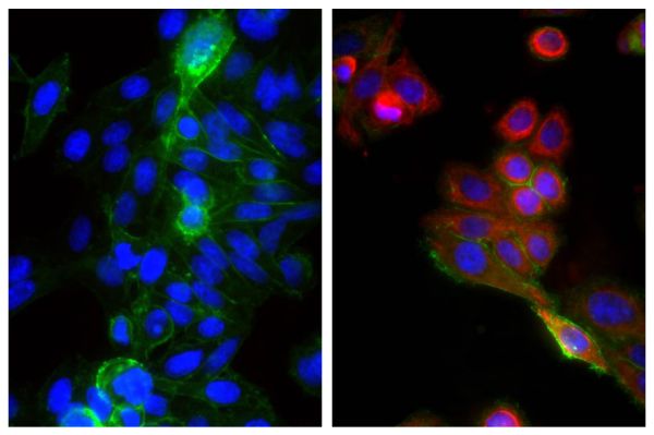 Human epithelial carcinoma cell line HEp-2 was stained with Mouse Anti-Cytokeratin 18-UNLB (SB Cat. No. 10085-01; right) and Mouse Anti-Human CD44-FITC (SB Cat. No. 9400-02) followed by Goat Anti-Mouse IgG<sub>2b</sub>, Human ads-TRITC (SB Cat. No. 1090-03) and DAPI.
