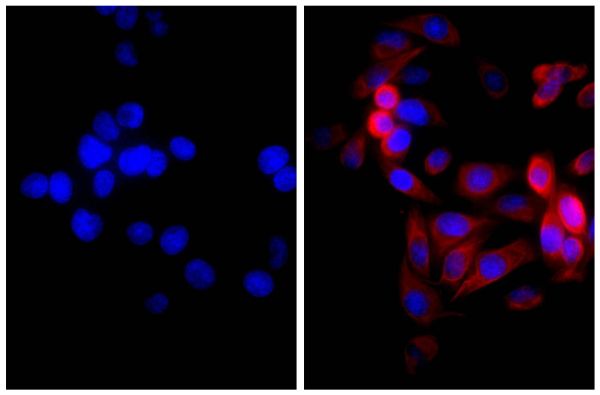 Human pancreatic carcinoma cell line MIA PaCa-2 was stained with Mouse Anti-Cytokeratin 18-UNLB (SB Cat. No. 10085-01; right) followed by Goat Anti-Mouse IgG(H+L), Rat ads-AF555 (SB Cat. No. 1034-32) and DAPI.
