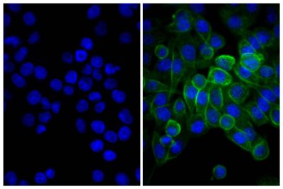 Human pancreatic carcinoma cell line MIA PaCa-2 was stained with Mouse Anti-Human CD44-UNLB (SB Cat. No. 9400-01; right) followed by Donkey Anti-Mouse IgG(H+L), Human SP ads-FITC (SB Cat. No. 6410-02) and DAPI.