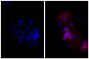 Human epithelial carcinoma cell line HEp-2 was stained with Mouse Anti-Human CD44-UNLB (SB Cat. No. 9400-01; right) followed by Goat Anti-Mouse IgG, Human ads-TXRD (SB Cat. No. 1030-07) and DAPI.
