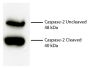 Total cell lysates from Jurkat cells were incubated with Rabbit Anti-Human DR5-UNLB (SB Cat. No. 6600-01), resolved by electrophoresis, transferred to PVDF membrane, and probed with Rat Anti-Human Caspase-2-UNLB (SB Cat. No. 17100-01). Proteins were visu