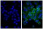 Human pancreatic carcinoma cell line MIA PaCa-2 was stained with Mouse Anti-Human CD44-UNLB (SB Cat. No. 9400-01; right) followed by Donkey Anti-Mouse IgG(H+L), Human SP ads-FITC (SB Cat. No. 6410-02) and DAPI.