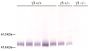 Serum from MRL/lpr IgG<sub>3</sub> +/+, +/-, and -/- mice was resolved by electrophoresis, transferred to PVDF membrane, and probed with Goat Anti-Mouse IgG<sub>3</sub>, Human ads-AP (SB Cat. No. 1100-04) followed by BCIP/NBT.<br/>Image from Greenspan NS, Lu MA, Shipley JW, Ding X, Li Q, Sultana D, et al. IgG<sub>3</sub> deficiency extends lifespan and attenuates progression of glomerulonephritis in MRL/<i>lpr</i> mice. Biol Direct. 2012;7:3. Figure 2<br/>Reproduced under the Creative Commons license https://creativecommons.org/licenses/by/2.0/
