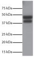 Total cell lysates from Jurkat cells were resolved by electrophoresis, transferred to PVDF membrane, and probed with Rabbit Anti-Human DR5-UNLB (SB Cat. No. 6600-01). Proteins were visualized using Goat Anti-Rabbit IgG(H+L), Mouse/Human ads-HRP (SB Cat.