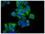 Human epithelial carcinoma cell line HEp-2 was stained with Mouse Anti-Cytokeratin 18-UNLB (SB Cat. No. 10085-01) followed by Goat Anti-Mouse IgG<sub>2b</sub>, Human/Bovine/Horse SP ads-FITC (SB Cat. No. 1093-02) and DAPI.