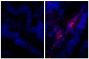 Paraffin embedded human gastric cancer tissue was stained with Rabbit IgG-UNLB isotype control (SB Cat. No. 0111-01; left) and Rabbit Anti-Human IgG(H+L), Mouse ads-UNLB (SB Cat. No. 6145-01; right) followed by Donkey Anti-Rabbit IgG(H+L), Mouse/Rat/Human SP ads-AF555 (SB Cat. No. 6440-32) and DAPI.