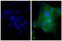 Human epithelial carcinoma cell line HEp-2 was stained with Mouse Anti-Human CD44-UNLB (SB Cat. No. 9400-01; right) followed by Goat F(ab')<sub>2</sub> Anti-Mouse Ig, Human ads-FITC (SB Cat. No. 1012-02) and DAPI.