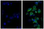 Human pancreatic carcinoma cell line MIA PaCa-2 was stained with Mouse Anti-Cytokeratin 18-UNLB (SB Cat. No. 10085-01; right) followed by Rat Anti-Mouse IgG<sub>2b</sub>-FITC (SB Cat. No. 1186-02) and DAPI.