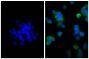 Human pancreatic carcinoma cell line MIA PaCa-2 was stained with Mouse Anti-Cytokeratin 18-UNLB (SB Cat. No. 10085-01; right) followed by Goat F(ab')<sub>2</sub> Anti-Mouse IgG(H+L), Human ads-BIOT (SB Cat. No. 1032-08), Streptavidin-FITC (SB Cat. No. 7100-02), and DAPI.
