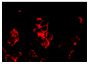 Frozen human synovial tissue section was stained with Mouse Anti-Human CD8-BIOT (SB Cat. No. 9536-08) followed by Alexa Fluor<sup>®</sup> conjugated streptavidin.<br/>Image from van Baarsen LG, Lebre MC, van der Coelen D, Aarrass S, Tang MW, Ramwadhdoebe TH, et al. Heterogeneous expression pattern of interleukin 17A (IL-17A), IL-17F and their receptors in synovium of rheumatoid arthritis, psoriatic arthritis and osteoarthritis: possible explanation for nonresponse to anti-IL-17 therapy?. Arthritis Res Ther. 2014;16:426. Figure S2<br/>Alexa Fluor<sup>®</sup> is a registered trademark of Thermo Fisher Scientific, Inc. or its subsidiaries<br/>Reproduced under the Creative Commons license https://creativecommons.org/licenses/by/4.0/