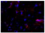 Frozen equine sacroid tissue section was stained with anti-MHC I followed by Goat Anti-Mouse IgG<sub>2a</sub>, Human ads-TRITC (SB Cat. No. 1080-03) and DAPI.<br/>Image from Wilson AD, Hicks C. Both tumour cells and infiltrating T-cells in equine sarcoids express FOXP3 associated with an immune-supressed cytokine microenvironment. Vet Res. 2016;47:55. Figure 5(h)<br/>Reproduced under the Creative Commons license https://creativecommons.org/licenses/by/4.0/