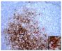 Paraffin embedded scrapie-infected sheep retropharyngeal lymph node section was stained with anti-120 kDa followed by Rat Anti-Mouse IgM-HRP (SB Cat. No. 1139-05) and DAB along with anti-prion protein followed by secondary reagents and Fast Red.<br/>Image from Dassanayake RP, Truscott TC, Özyiğit MÖ, Zhuang D, Schneider DA, O'Rourke KI. Accumulation profiles of PrP<sup>Sc</sup> in hemal nodes of naturally and experimentally scrapie-infected sheep. BMC Vet Res. 2013;9:82. Figure 3(g)<br/>Reproduced under the Creative Commons license https://creativecommons.org/licenses/by/2.0/