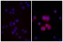 Human pancreatic carcinoma cell line MIA PaCa-2 was stained with Mouse Anti-Human CD44-UNLB (SB Cat. No. 9400-01; right) followed by Donkey Anti-Mouse IgG(H+L), Multi-Species SP ads-BIOT (SB Cat. No. 6415-08), Streptavidin-TXRD (SB Cat. No. 7100-07), and DAPI.