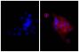 Human epithelial carcinoma cell line HEp-2 was stained with Mouse Anti-Human CD44-UNLB (SB Cat. No. 9400-01; right) followed by Goat Anti-Mouse IgG, Human ads-TRITC (SB Cat. No. 1030-03) and DAPI.